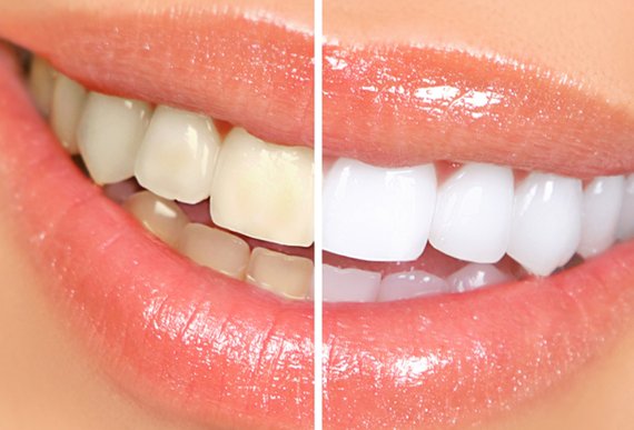 Polymed-Doboj Polymed-Doboj