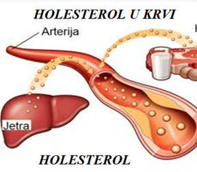 Poremećaj lipidnog statusa